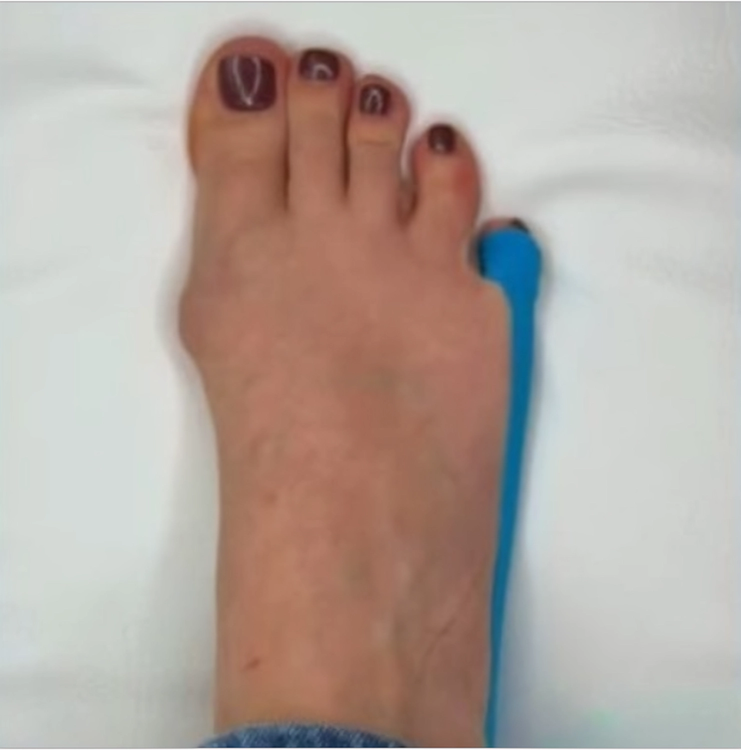 Mobile Fachfusspflege – Vorher-Nachher-Ergebnisse