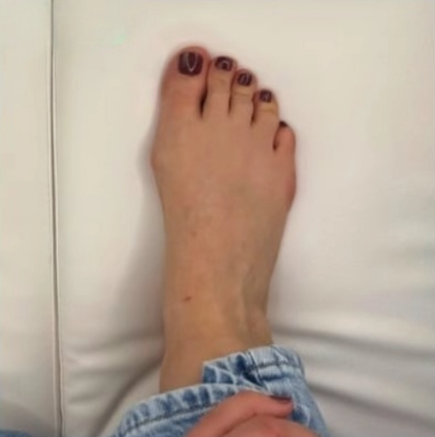 Mobile Fachfusspflege – Vorher-Nachher-Ergebnisse