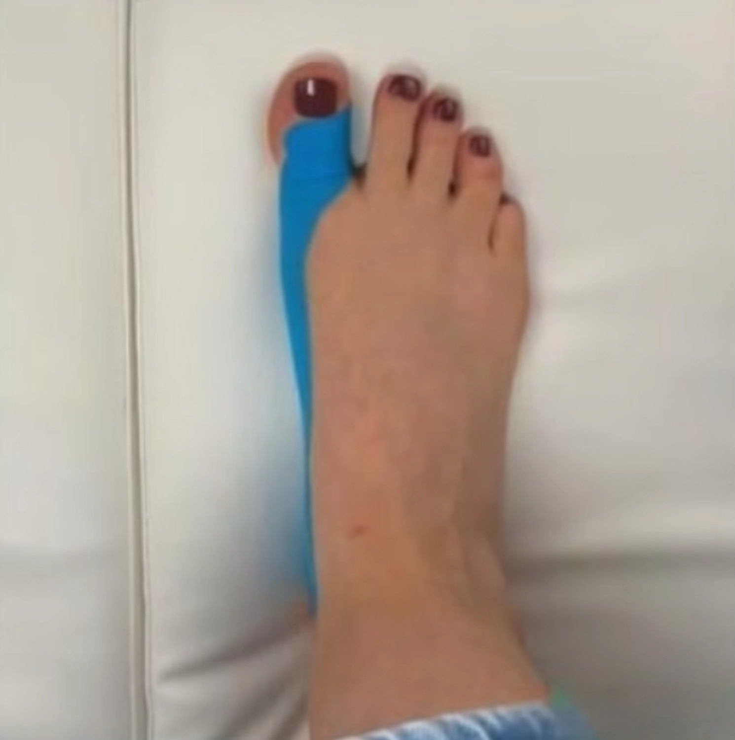 Mobile Fachfusspflege – Vorher-Nachher-Ergebnisse