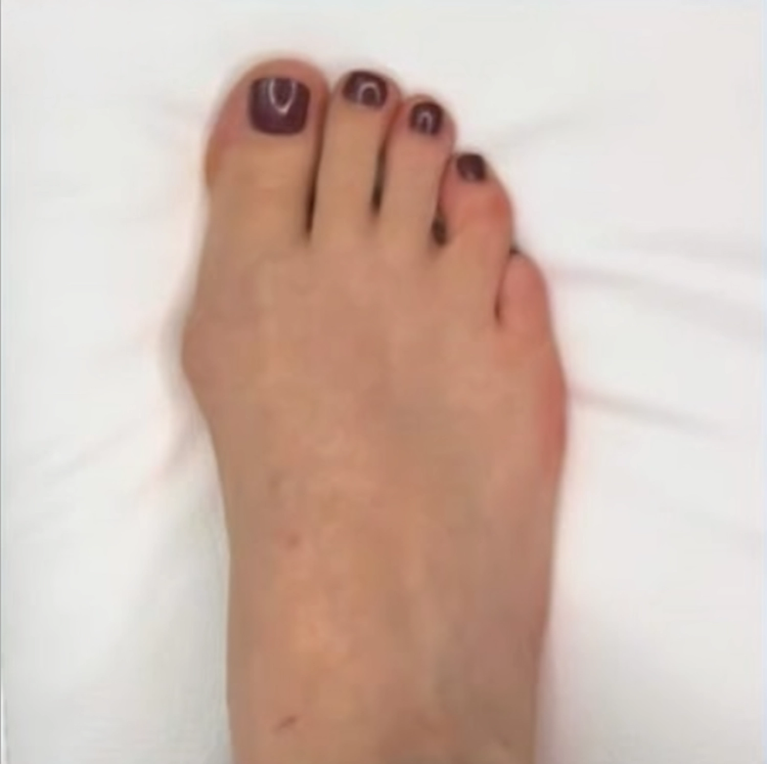 Mobile Fachfusspflege – Vorher-Nachher-Ergebnisse