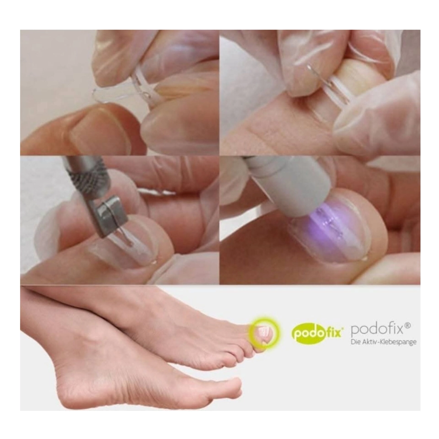 Mobile Fachfusspflege – Vorher-Nachher-Ergebnisse